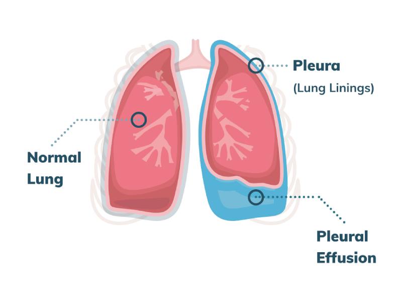 Pratham Chest and Allergy Hospital | Fefsa Hospital in Palanpur | Chest ...